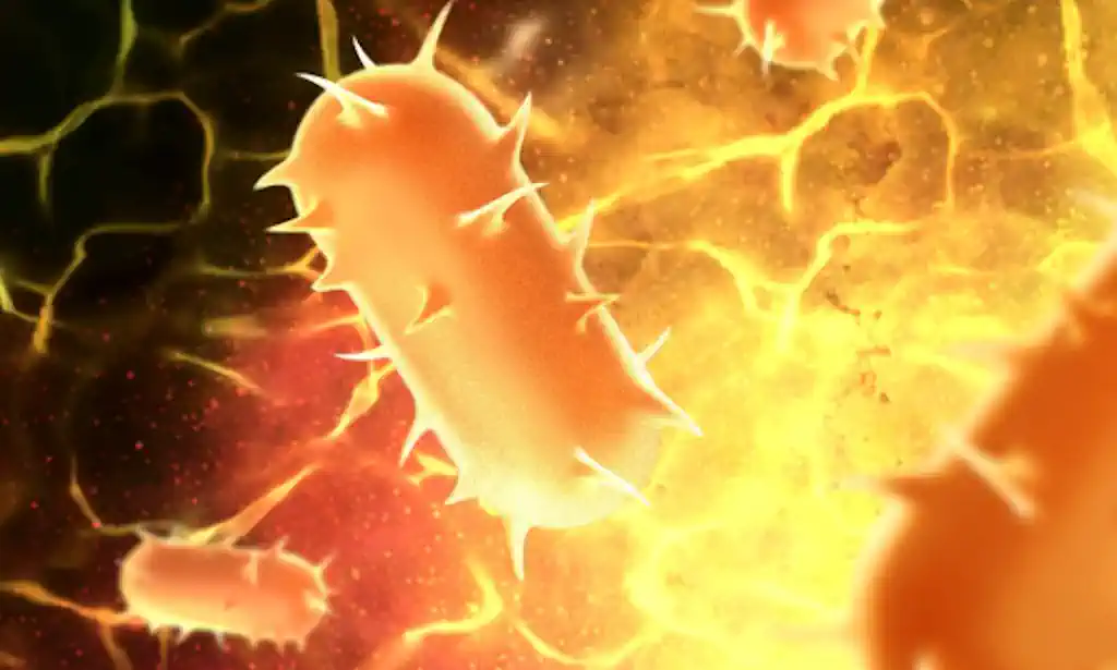 Upala pluća (Pneumonija): Etiologija, klinička slika i suvremeni pristupi liječenju